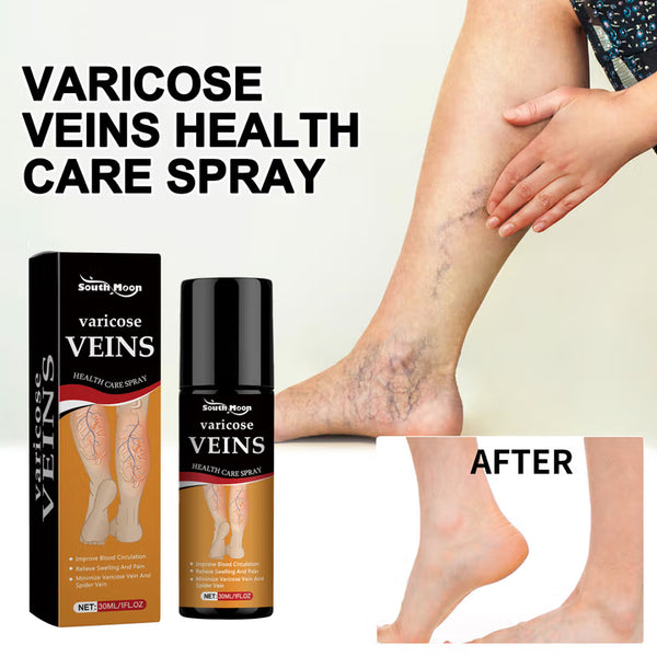 šæ Varicose Vein Relief Spray ā Soothing Comfort in Every Spray! š§